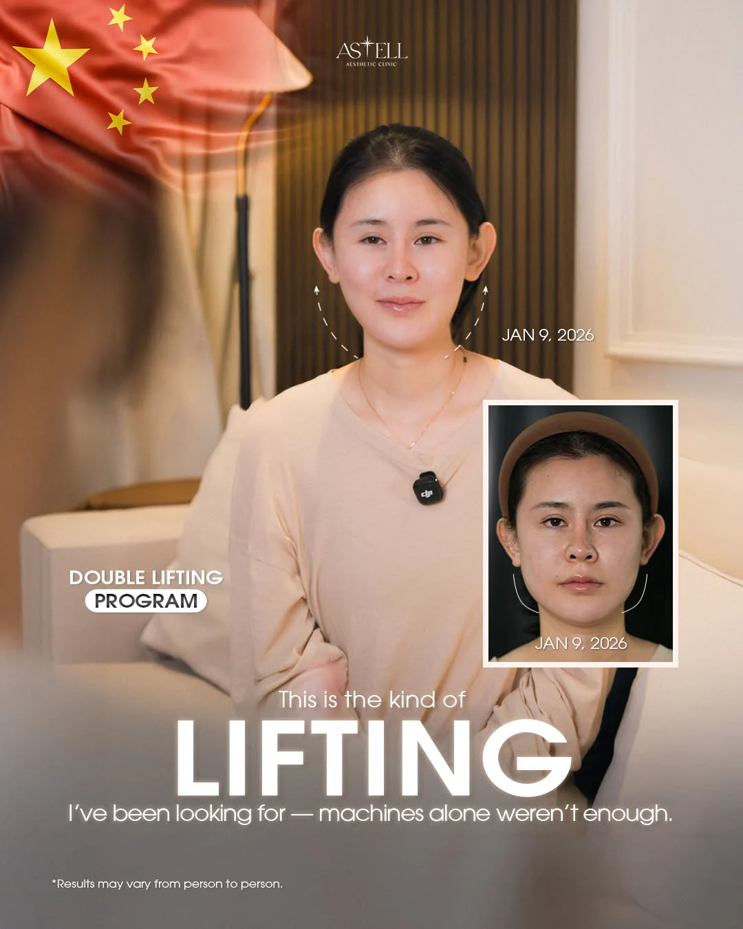Patient from China — lifting result